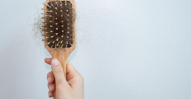 Welcher Arzt kann bei Haarausfall helfen? Ihr umfassender Leitfaden
