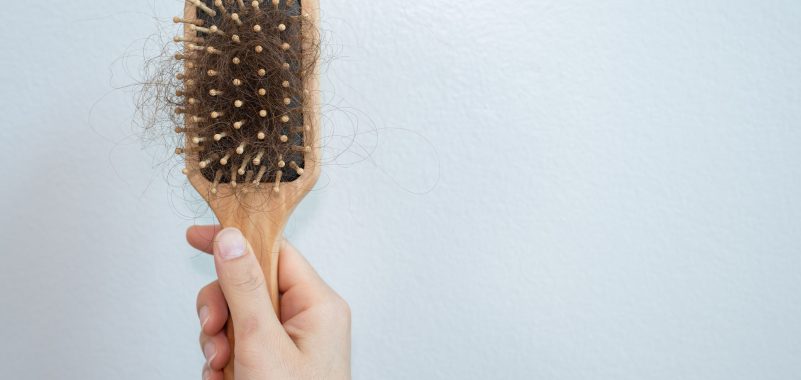 Haarbüschel in Haarbürste stehen für Haarausfall welcher Arzt